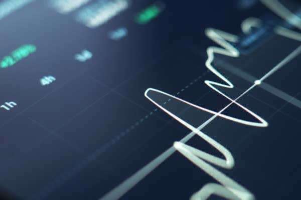 老虎环球和 Adage Capital 第四季度减持人工智能重量级公司股票